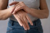 Burn Physical Therapist Guide